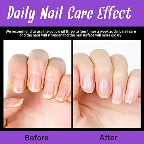 Fandamei Cuticle Oil, 2Pcs Nail Cuticle Revitalizing Oil, Nail Cuticle Care Oil, Nourish And Moisturize Nails&Cuticles, Soothing And Strengthens Nails, Heals Dry Cracked Cuticles, Lavender, 0.42 Oz. #TOP5