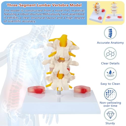 Image of 3 Section Lumbar Intervertebral Disc Human Skeleton Spine Model,Anatomical Vertebrae Model for Chiropractic,Patient Education Demonstration,Excellent Way for Demonstrating Disc