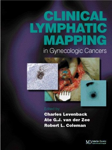 Clinical Lymphatic Mapping in Gynecologic Cancers Clinical Lymphatic Mapping in Gynecologic Cancers