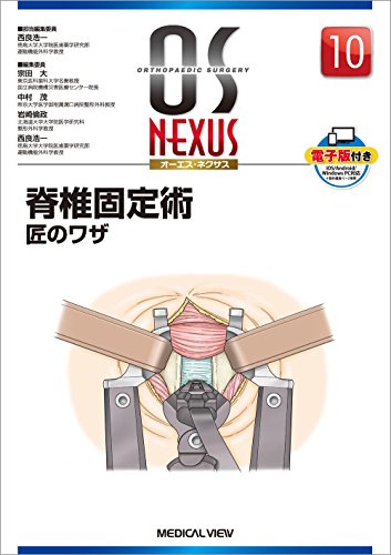 PDFダウンロード 脊椎固定術 匠のワザ (OS NEXUS(電子版付き) 10) バイ
