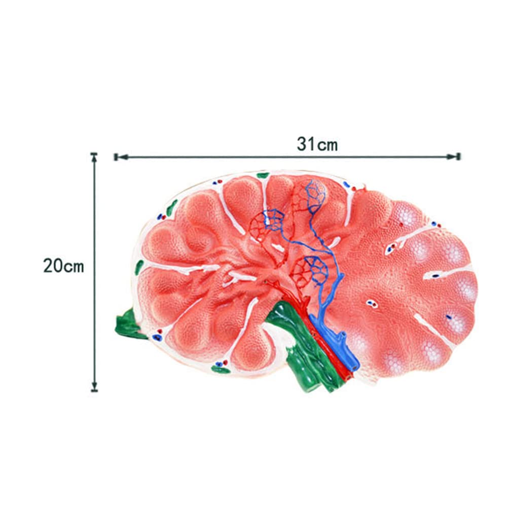Model powiększania węzłów chłonnych, model anatomiczny narządów ludzkich, model nauczania biologii gimnazjum, materiały medyczne,