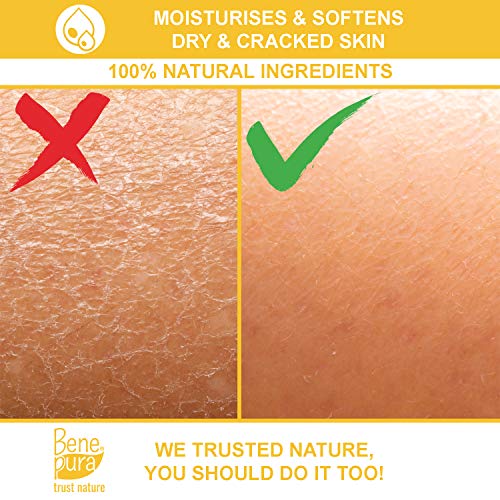 BenePura Propolis Salbe, Natürliche 30% Propolis Salbe für Juckende, Trockene und Rissige Haut, 40 ml (1er Pack) – Bild 4