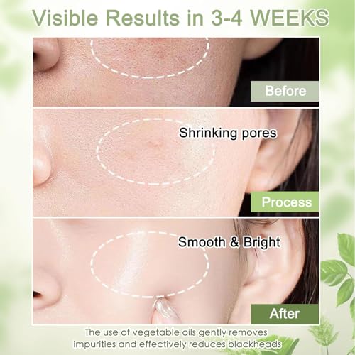 image for COSMOO Deep Cleansing Oil, Pore Control Oil Cleanser for Face, Makeup 