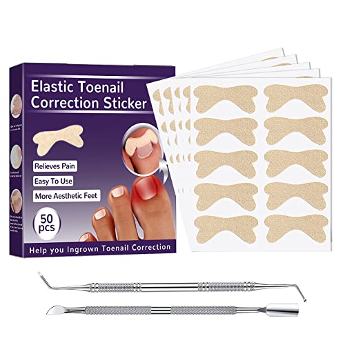 Zehennagel Korrektur Pflaster, Eingewachsene Zehennägel Patch, Toenail Corrector Patch, Klebefreies inklusiv Elastischer Patch Pediküre Aufkleber Fußnägel Nagelpflege Werkzeug Cover