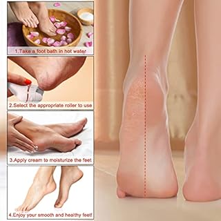 Pedicure Elettrico - Aottom Professionale Piedi Roll Elettrico Piedi Attrezzi Calli Talloni Screpolati Lima Elettrica per Piedi Togli e Duroni Ricaricabili con 3 Rulli Ricambio