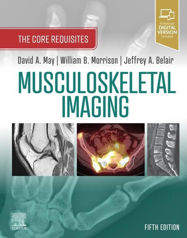 Musculoskeletal Imaging: The Core Requisites E-Book (English Edition)