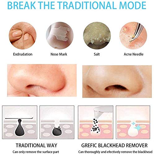 Aspiration points noirs et exfoliant visage pour éliminer les comédons - 2