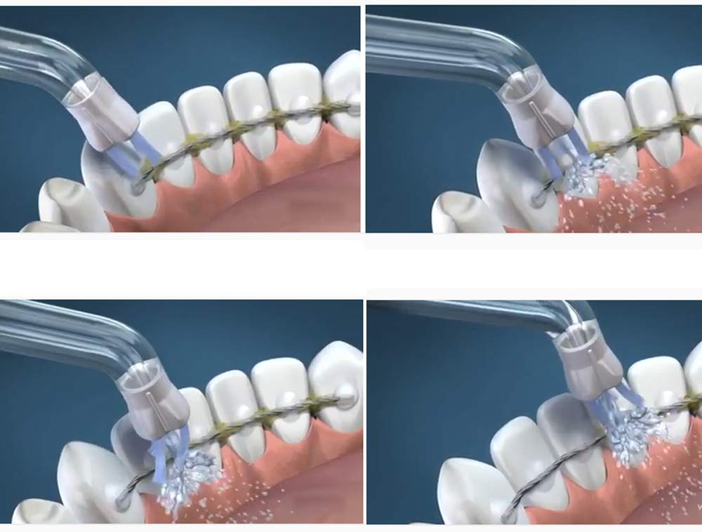Suggerimenti per la ricerca della placca di ricambio ad alta pressione per Waterpik WP-100 WP-250 WP-400 WP-660, Accessori ugelli, Parti di ricambio (4 pezzi)