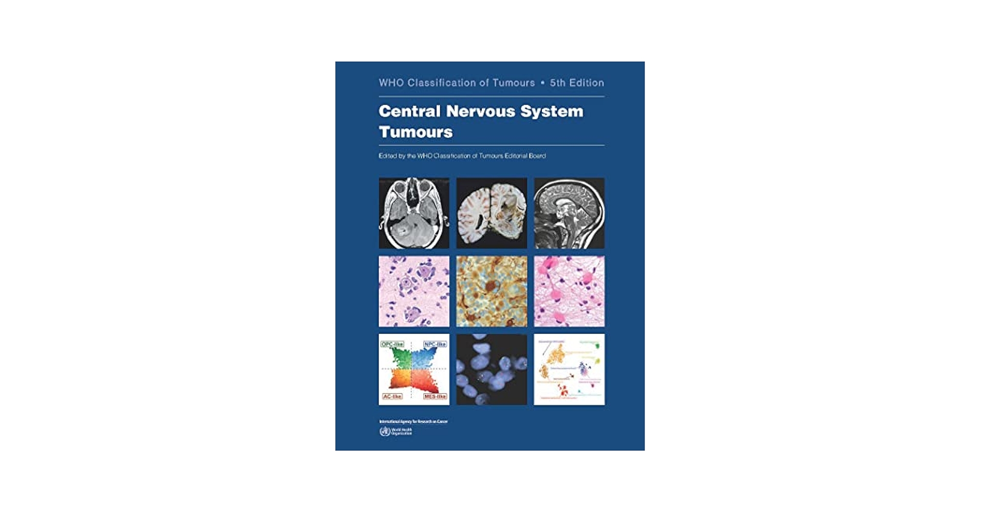 Central Nervous System Tumours: WHO Classification of