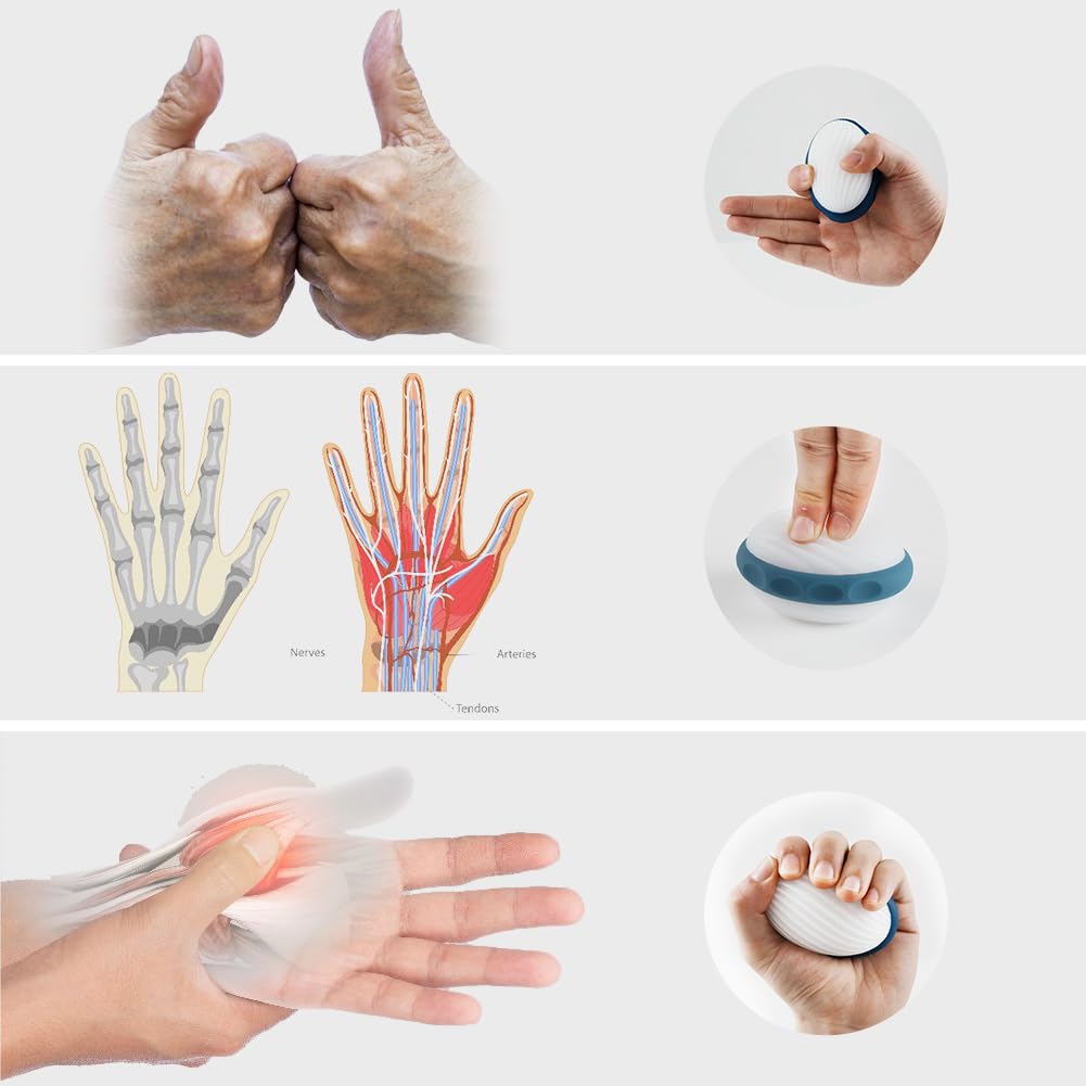 Remedic Ejercitador de manos y dedos – Fortalecedor de agarre con 2 anillos de resistencia y manual de entrenamiento con más de 30 ejercicios – Fortalece los músculos de las manos, articulaciones y