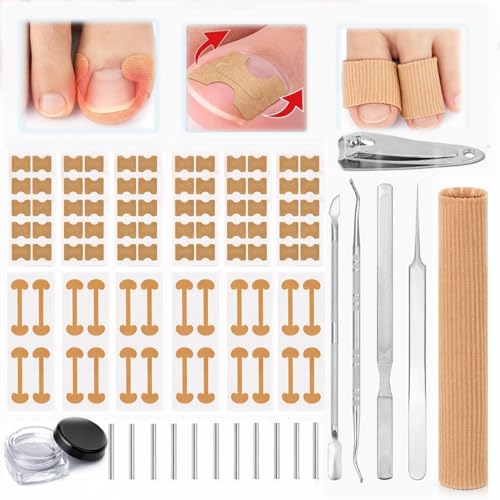 Ingrown Toenail Corrector & Toenail Correction Kit with Soft Breathable Strips Stainless Steel Tools and Elastic Fiber Toe Sleeves; Ideal for Runners Long-Hour Workers and Tight-Shoe Wearers