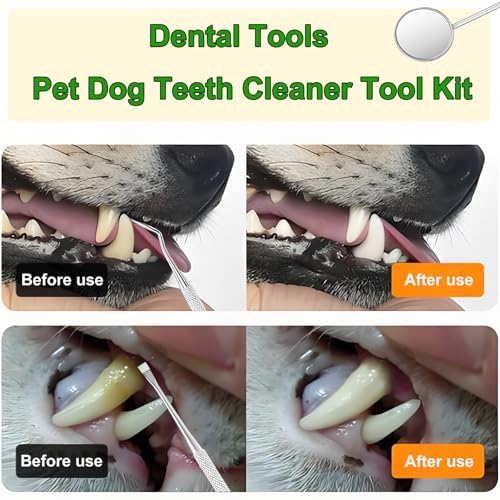 Image of Teeth Cleaner Tool Kit Stainless Steel Plaque Tartar Remover Set of 6 with Metal Case, Tweezers, Oral Mirror, Teeth Cleaner, Probe, Stain Remover