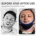 Anti Snoring Chin Strap, Adjustable Stop Snoring Chin Straps for CPAP Users, Jaw Strap for Sleeping for Men Women (Blue)