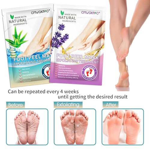 image for CMWGKBC 5 Pack Foot Peeling Mask,Exfoliator Peel Off Calluses Dead Ski