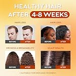 Batana Oil for Hair Growth Dr Sebi, 100% Raw Organic Batana Hair Mask from Honduras, Wild Growth Hair Oil, Scalp Oil Promotes Hair Thickness, Prevents Loss for Men & Women, 4.06 fl oz - Image 4