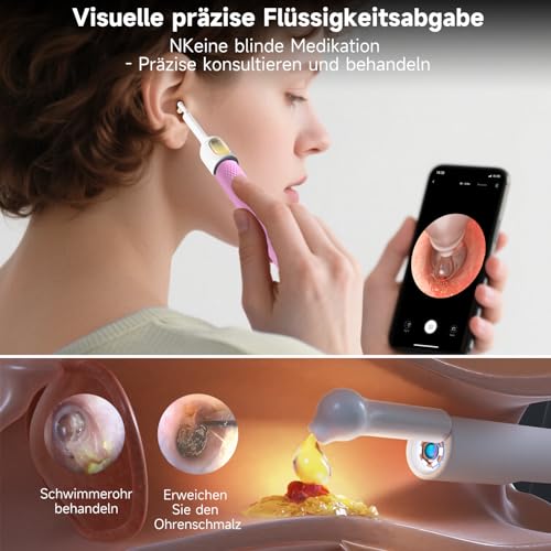 Image of BEBIRD R1 Ultra Ear Wax Removal, Ear Cleaner with Camera Ear Scope, Wax Remove Ear Pick with Ear Otoscope Tweezers, Visual Dropper Cleaning Kit, Ear /Nose /Throat Examination Tool for Family, Pink