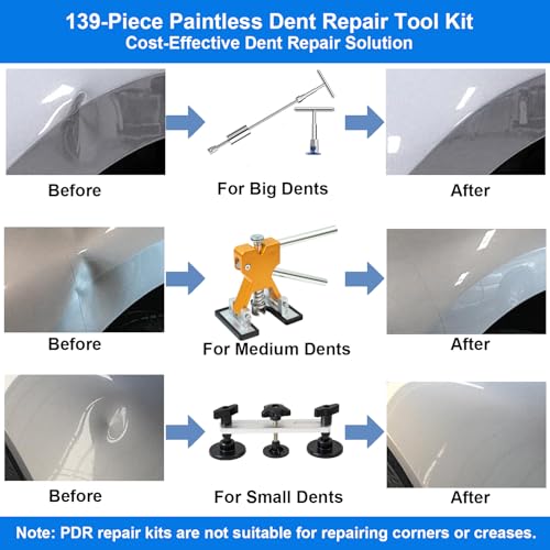 Image of 139PCS Paintless Dent Repair Kit, Professional Dent Puller Kit with Slide Hammer, Golden Lifter, Bridge Puller and PDR Tools, Car Dent Repair Kit for Hail Damage, Door Dings and Metal Dents