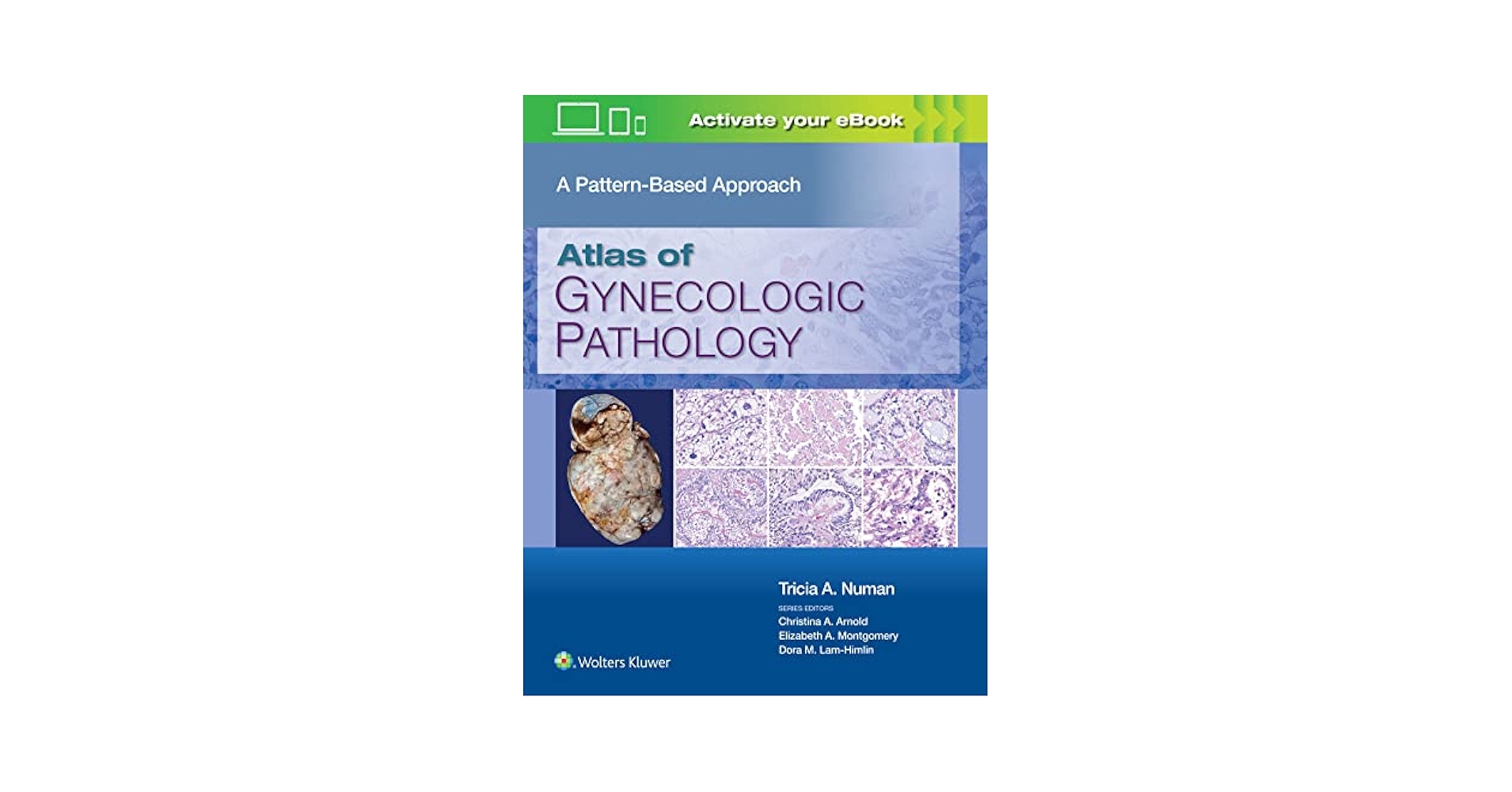 健康・医学 Atlas of Gynecologic Surgical Pathology Atlas of Gynecologic Surgical Pathology: Expert Consult