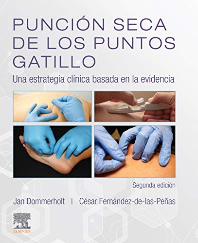 Punción Seca De Los Puntos Gatillo - 2ª Edición