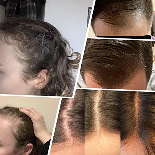 Koi Beauty Adjustable Derma Stamp Professional Microneedling Pen Dermapen For Face Body Hair Beard Growth, Microneedle Pen Roller For Men Women Home Use #TOP4