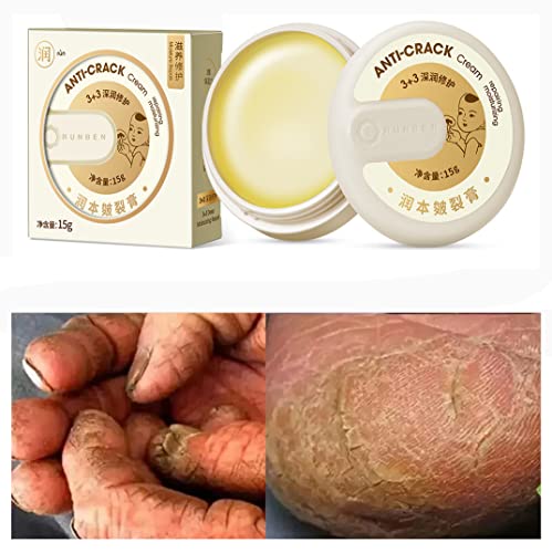 Hand and Foot Repair Cream Cracked Skin Repair Cream, Anti-Crack Winter, Moisturizing and Hydrating Heel Crack Repair Cream, Dry Foot Mask, Dry Heel Crack Repair Cream Remove Calluses Dead Skin Bicycle (2pcs Crack Repair Cream 30G)