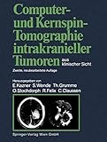 Computer- und Kernspin-Tomographie intrakranieller Tumoren aus klinischer Sicht