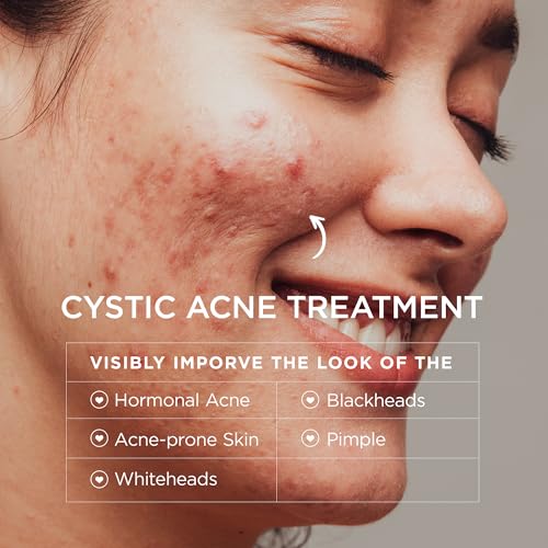 Image of BellamiLuxx Acne Lotion for Face: Acne Cream for Teens & Adults - Salicylic Acid & Tea Tree Oil Pimple Spot Remover - Anti-Acne Moisturizer Reduces Redness, Blemishes