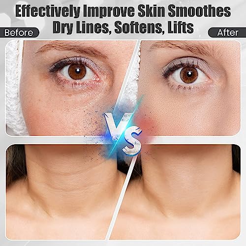 Hupzund Neck Face Firming Wrinkle Removal Tool, Double Chin Reducer Tool, Skin Rejuvenation Beauty Massager For Skin Care,Improve,Firm,Tightening And Smooth #TOP6