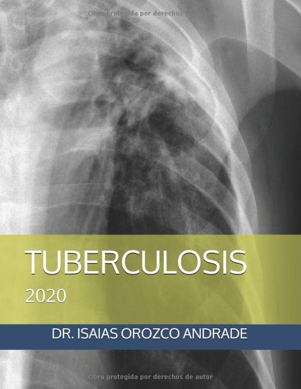 TUBERCULOSIS: 2020 (Spanish Edition)