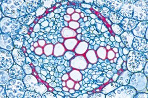 3B Scientific GmbH W13047 Angiosperm III. Roots English, Grade: 1 to 2