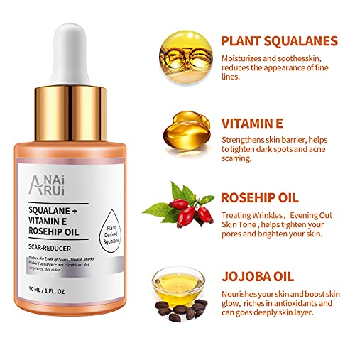 Anai Rui Squalane + Vitamin E Rosehip Oil Moisturizer For Face Hydrate, Reduce Scars And Stretch Marks, Wrinkles For Smoother, Softer Skin 1 Fl. Oz #TOP4