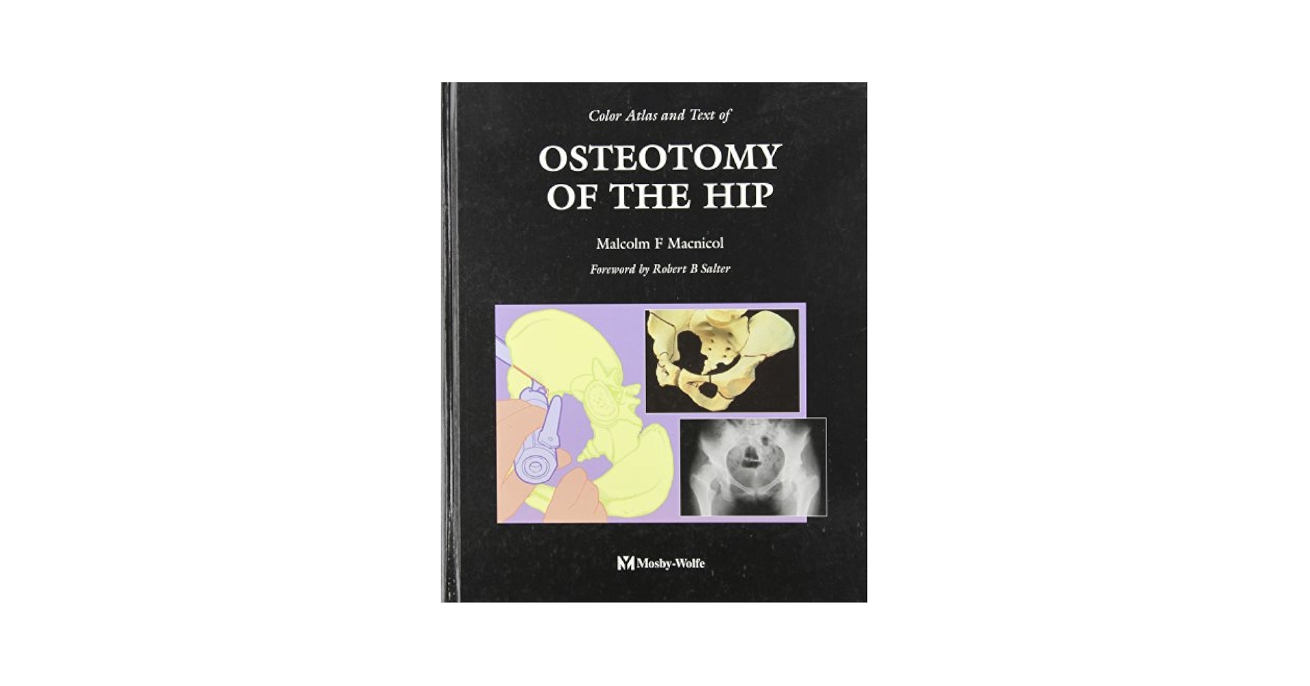 Amazon | Color Atlas And Text Of Osteotomy Of The Hip, 1e