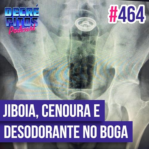 Decr&eacute;pitos 464 - VACILO NEWS: Jiboia bate ponto, Cenoura no boga e Desodorante no reto