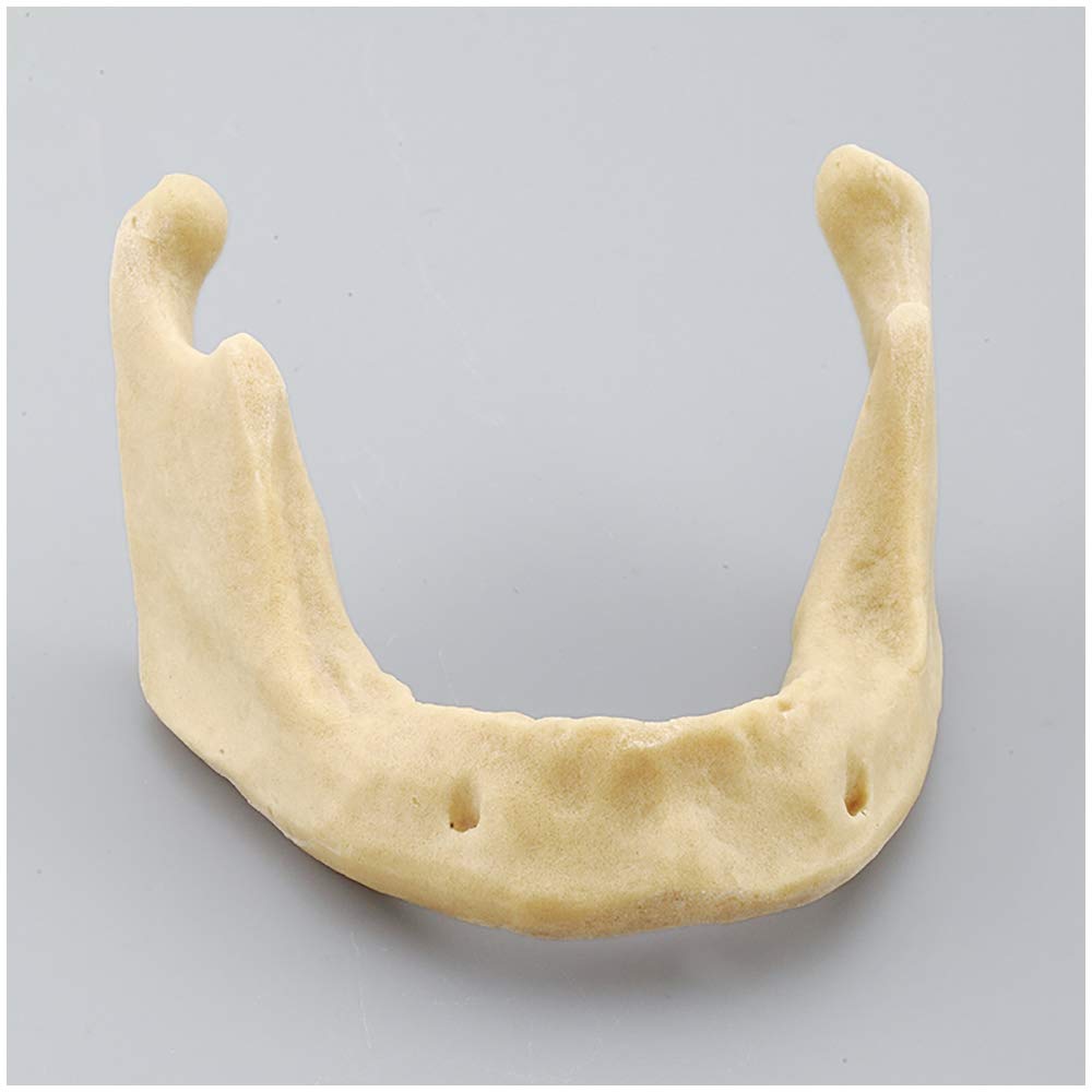Sjdopulse A Dental Teeth Study Teaching Model - Mandible Implant Practice Model Without Gingiv - Dental Training Tooth Model Implanted Mandible Implant Model For Teeth Implant Practice Study (A)