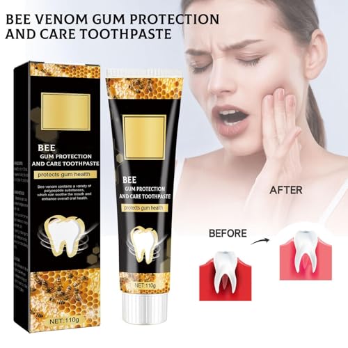 Bienengift Zahnpasta,Bienengift Zahnfleischpflege Zahnpasta Tiefenreinigung Zahnstein Flecken Zahnstein Geruch Frischer Atem Whitening Zahnpasta (2)