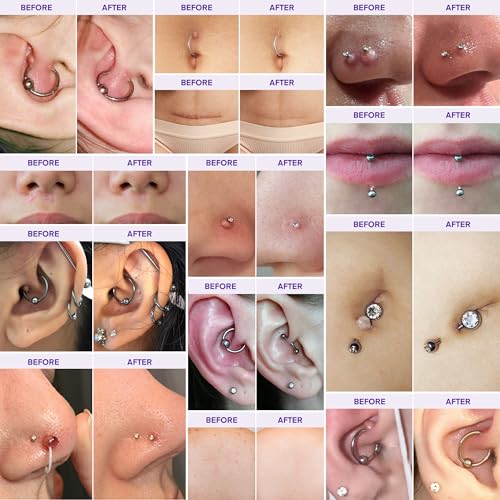 Image of Keloid Bump Removal Gel | For Piercing Bumps, Keloids, Hypertrophic Scars & Acne Marks | With Salicylic Acid, Centella, EGF & Ceramides | Smooths, Hydrates & Supports Skin Renewal - 0.71 oz / 20g