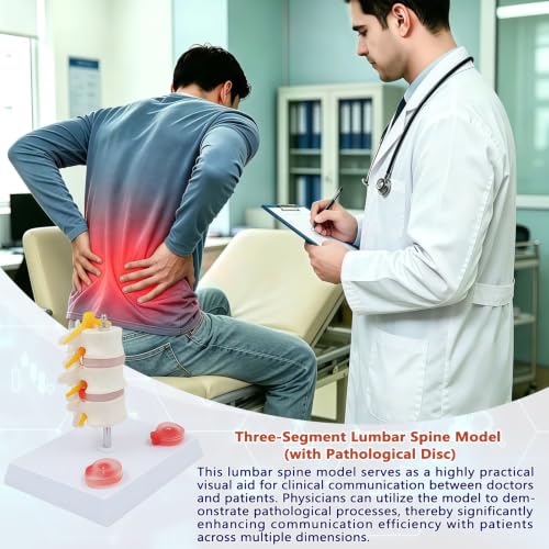 Image of 3 Section Lumbar Intervertebral Disc Human Skeleton Spine Model,Anatomical Vertebrae Model for Chiropractic,Patient Education Demonstration,Excellent Way for Demonstrating Disc