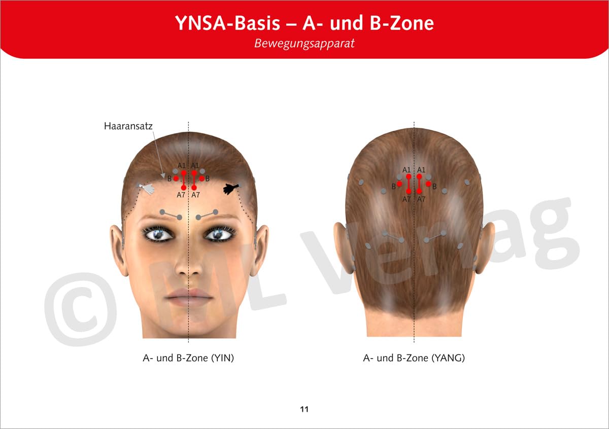 Schädelakupunktur nach Yamamoto (YNSA): Kartenset für die Praxis