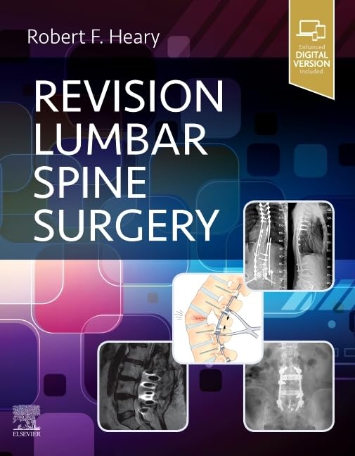Buy Revision Lumbar Spine Surgery (Hb 2022) — BookShops.in
