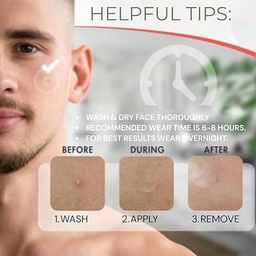 Miniatura 8 de Parche para espinillas para hombres, parche hidrocoloide ultrafino para acné con ácido salicílico, centella y aceite de árbol de té. Combate brotes