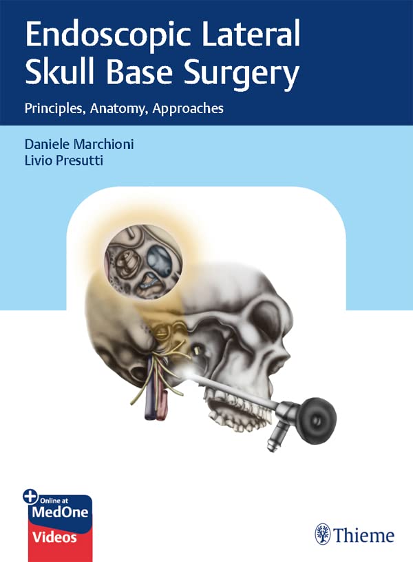 Endoscopic Lateral Skull Base Surgery: Principles, Anatomy, Approaches (English Edition)