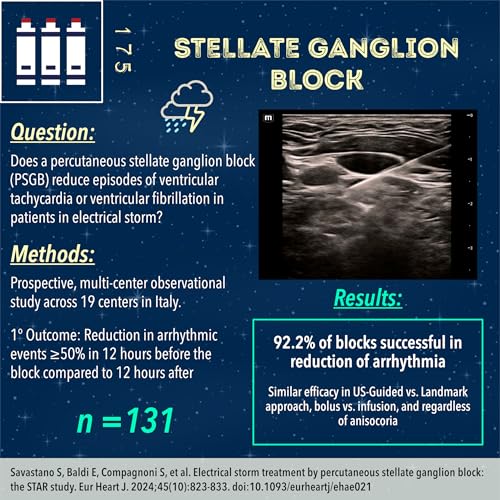 Stellate Ganglion Block