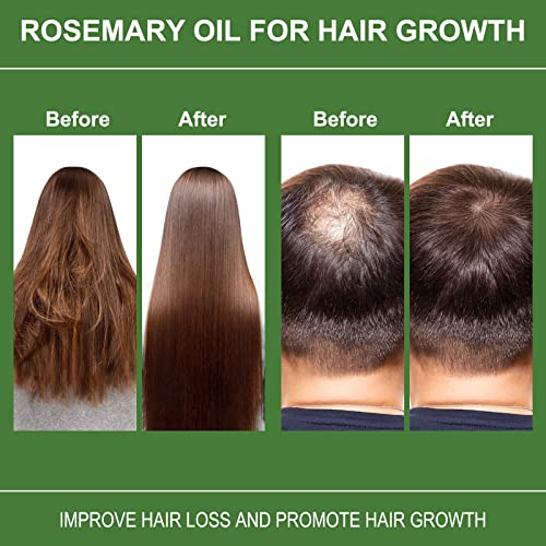 Rosemary Oil For Hair Growth 120ml, Rosemary Oil Pure Organic, Improve Hair Loss & Promote Hair Growth, Rosemary Hair Oil For Men Women - Image 4