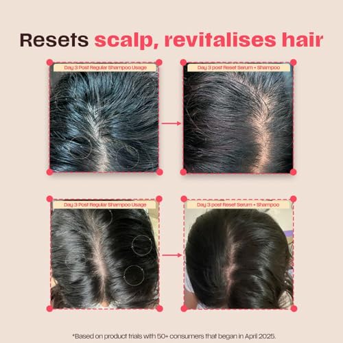 Image of Days Ahead Pre-Wash Reset Serum | For Oily Scalp | Controls Oil, Buildup & Flakes | 11% Active Ingredients | Salicylic Acid, Glycolic Acid, Niacinamide, Ceramide | For All Hair Types | For Women & Men