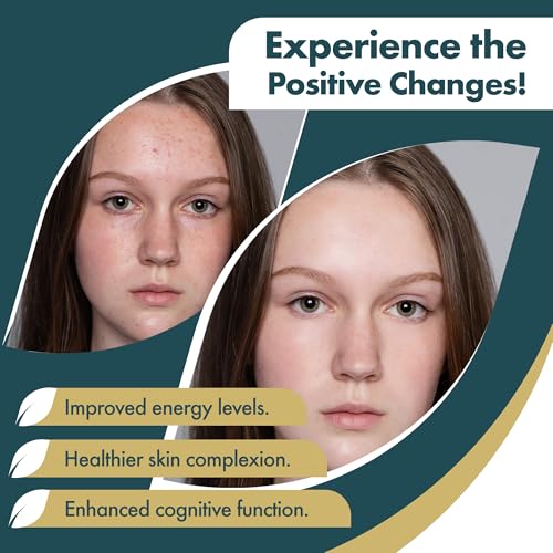 Omega 3 Fish Oil Softgel 2000 mg - Ultimate EPA DHA Supplement for Men and Women - Burpless - No Fishy Taste - Unflavored 180 Softgels - Organic, Non GMO - Made in The USA - Image 6