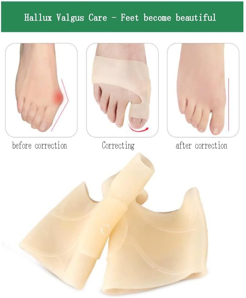 DEAVER Big Toe Overlap Correction, Hallux Valgus Splitter, Insoles Silica Gel Pad Protectors,Toe Caps Blister Protectors, Metatarsal for Forefoot Cushion