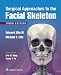Surgical Approaches to the Facial Skeleton