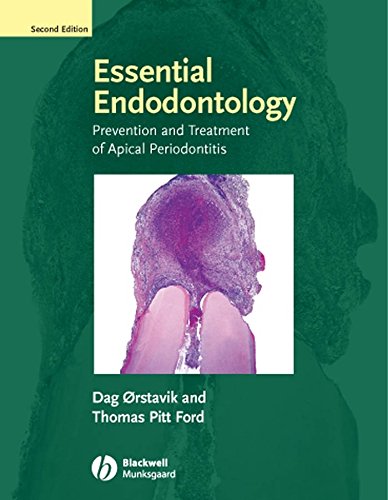 Essential Endodontology: Prevention and Treatment of Apical Perio