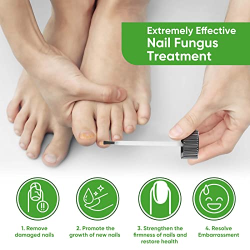 Toenail Fungus Treatment, Extra Strength Nail Repair Solution For Fingers And Toenails With Natural Tea Tree Oil Extract, Toenail Repair Solution For Thickened And Ingrow Nails, 30Ml #TOP1