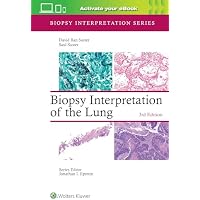 Biopsy Interpretation of the Lung
